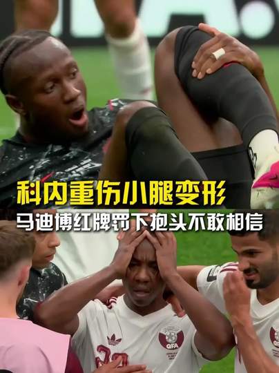 加拿大球员小腿恐怖变形：NBA伤病数据榜揭示最易折损位置